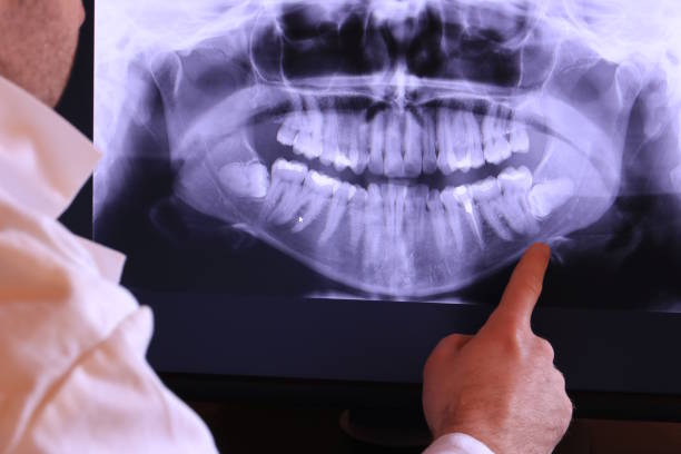 Best Emergency Root Canal Treatment in Harrogate, TN