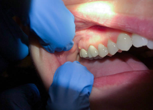 Best Pediatric Emergency Dentist in Harrogate, TN